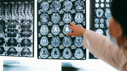 Dificultățile din copilărie pot afecta materia albă a creierului, arată un studiu